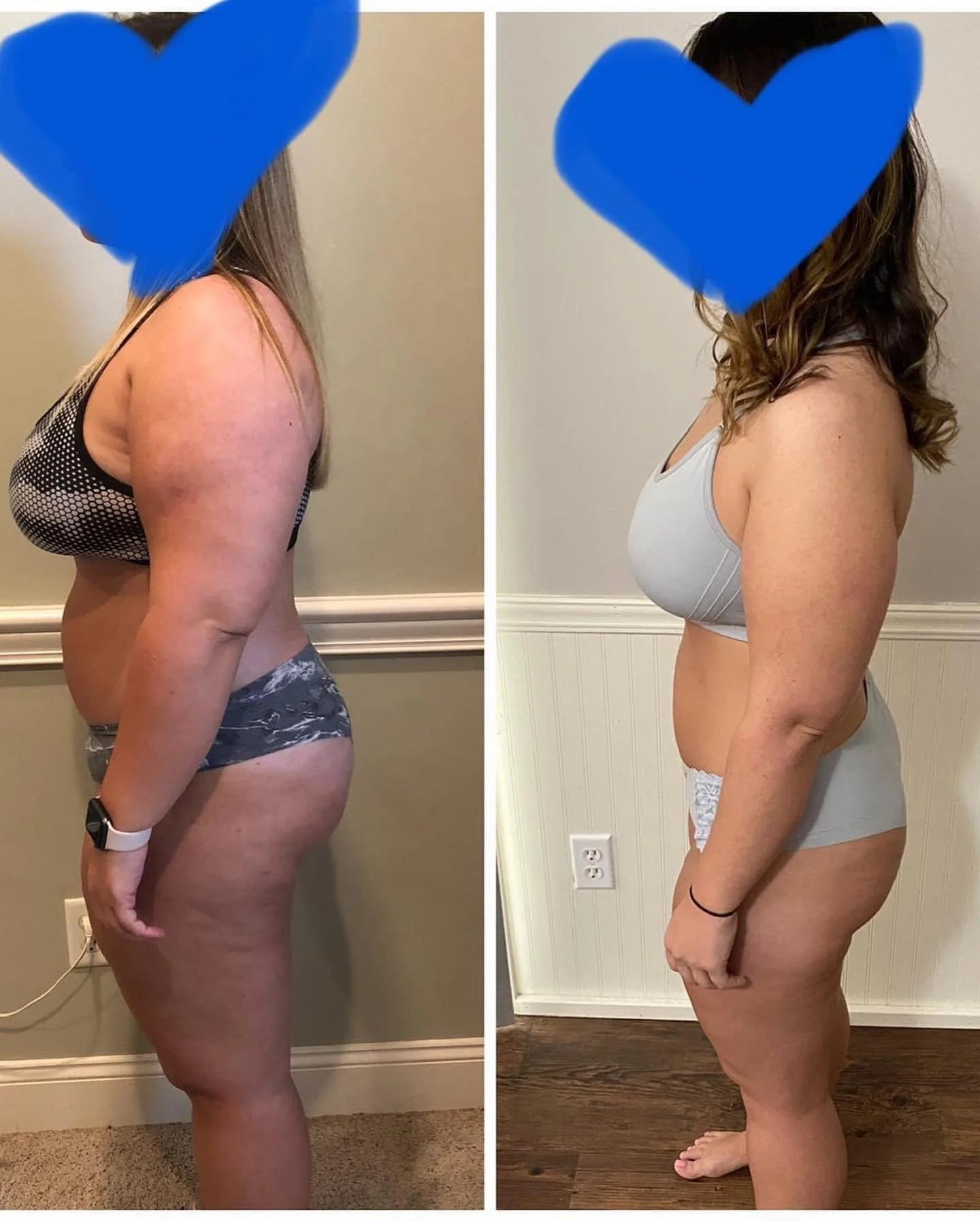 Side-by-side comparison of a person wearing underwear in two different settings, showing significant weight loss.